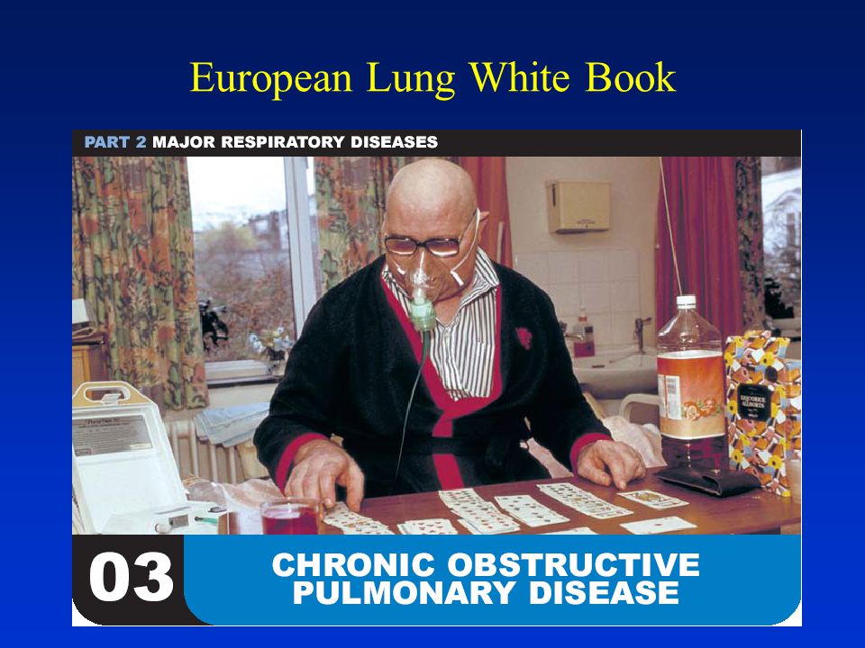 European Lung White Book