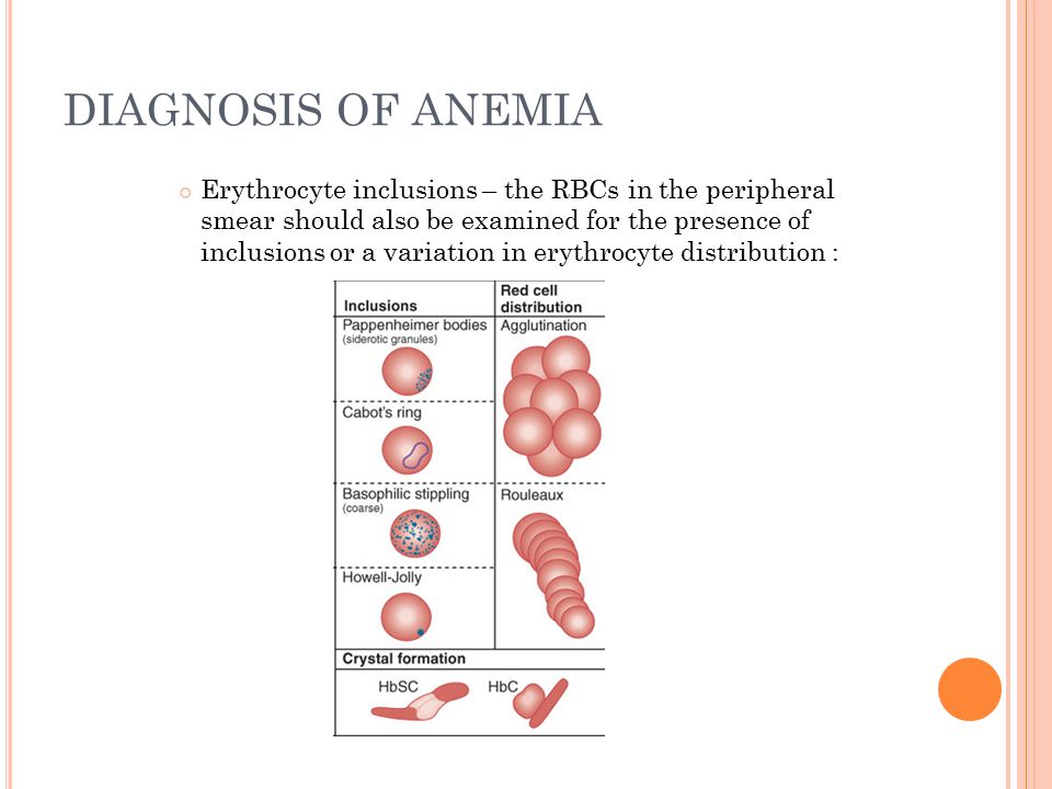 Diagnosis of anemia.