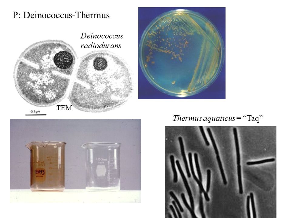 Deinococcus radiodurans - microbewiki