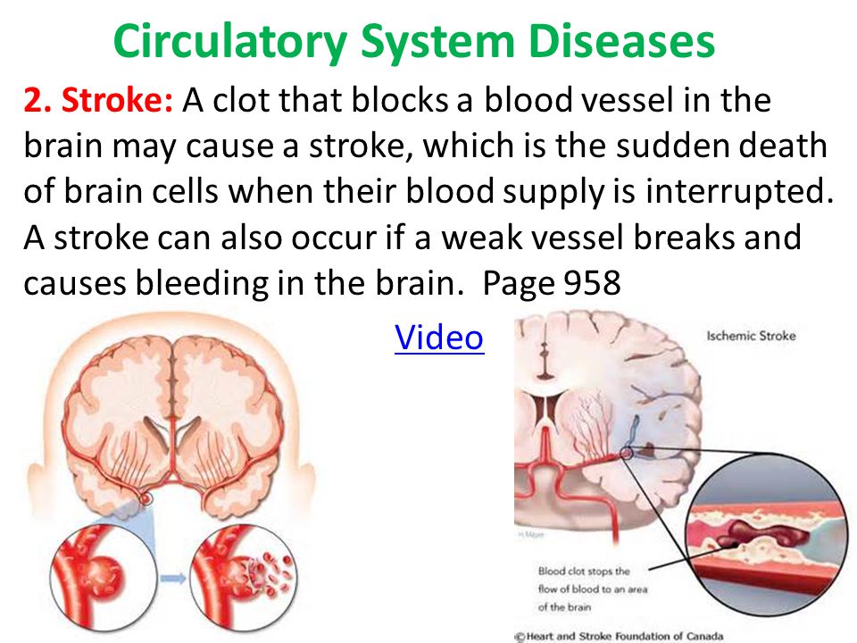 Circulatory System Diseases