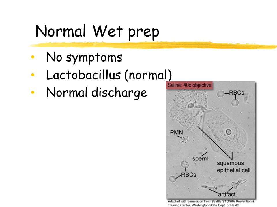 Normal Wet prep No symptoms Lactobacillus (normal) Normal discharge