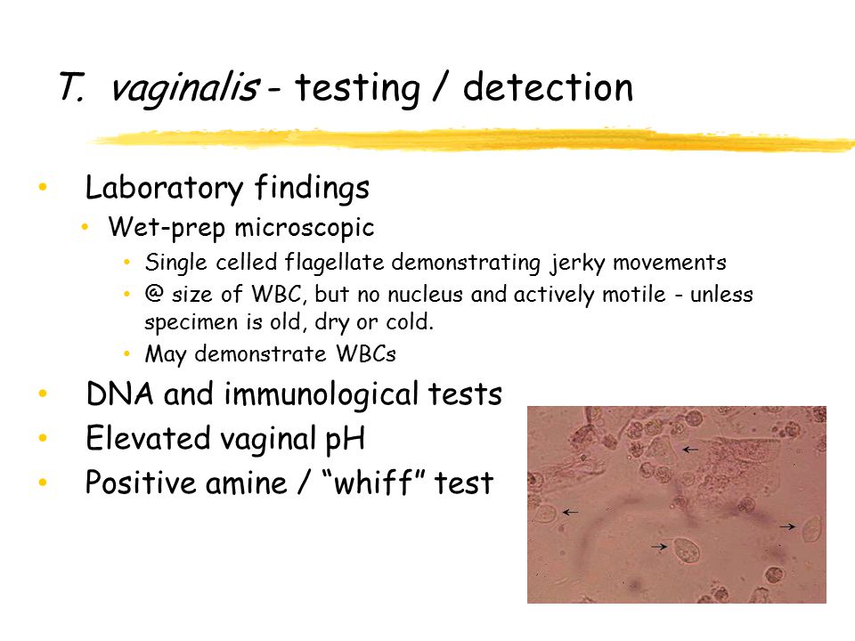 T. vaginalis - testing / detection