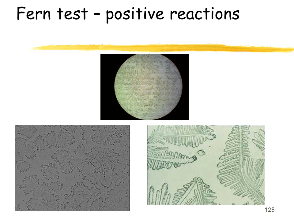 Fern test – positive reactions