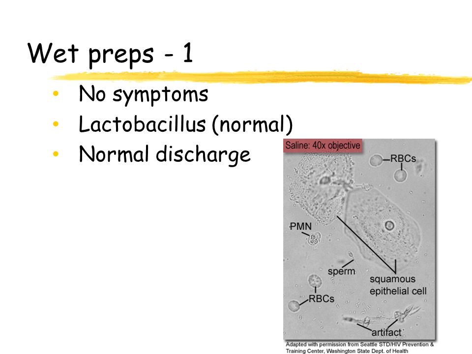 Wet preps - 1 No symptoms Lactobacillus (normal) Normal discharge