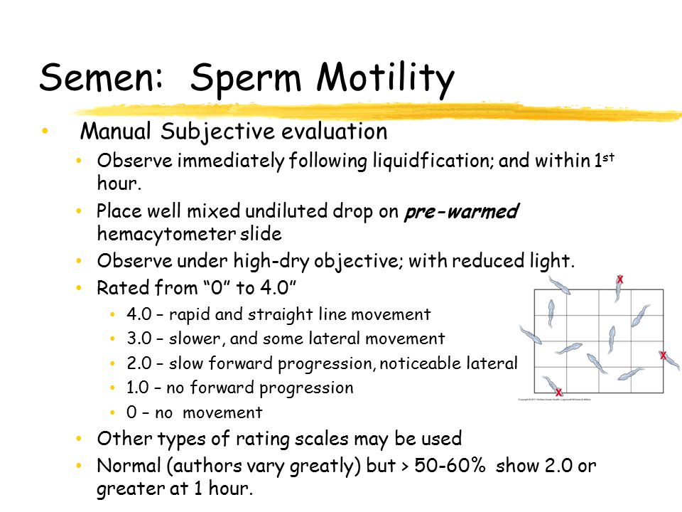 Semen: Sperm Motility Manual Subjective evaluation