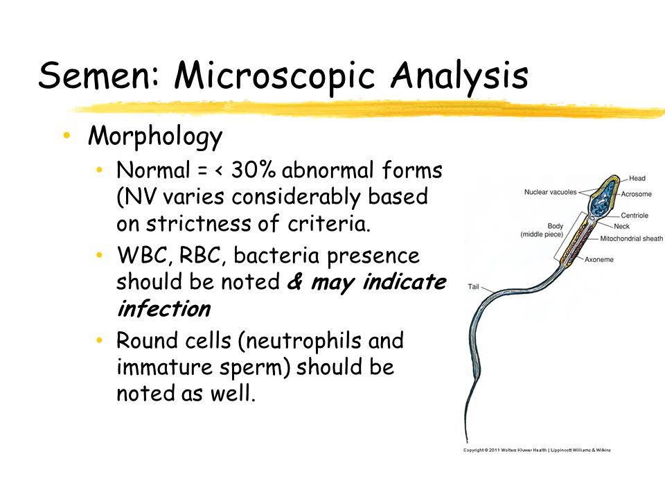 Semen: Microscopic Analysis