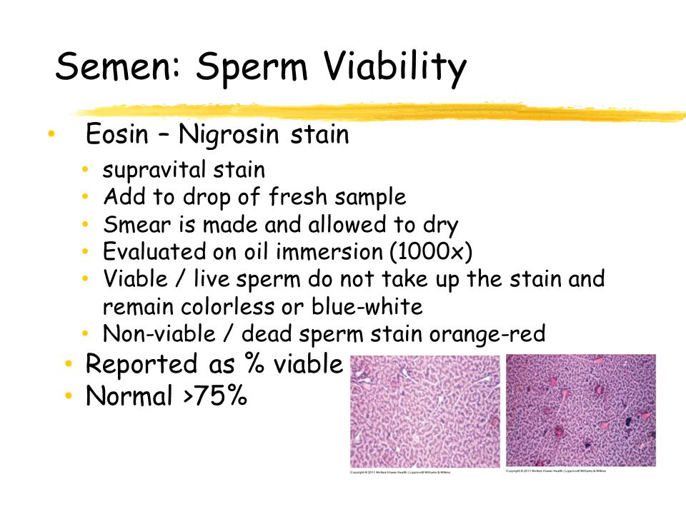 Semen: Sperm Viability