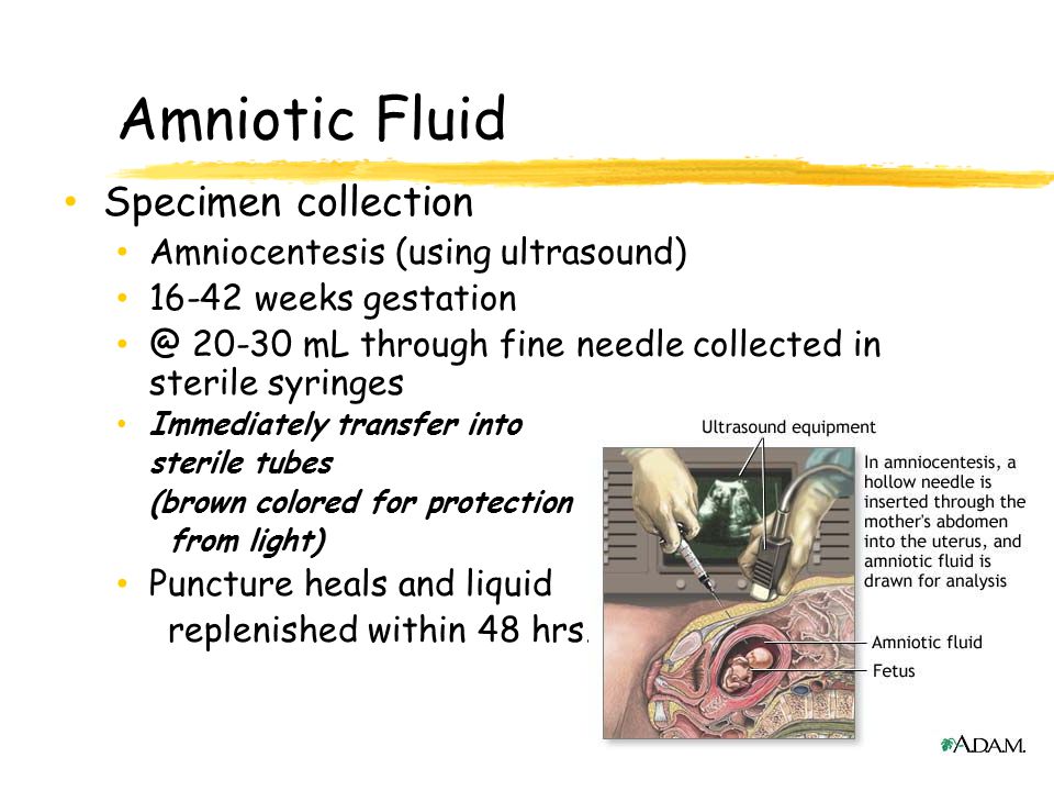 Amniotic Fluid Specimen collection Amniocentesis (using ultrasound)