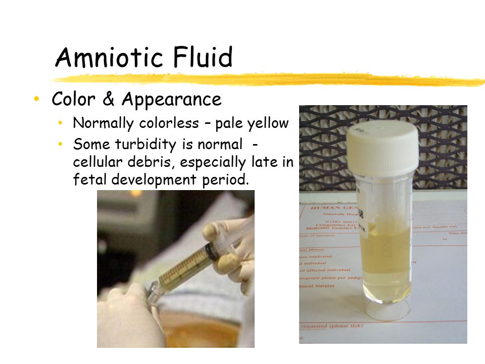 Amniotic Fluid Color & Appearance Normally colorless – pale yellow