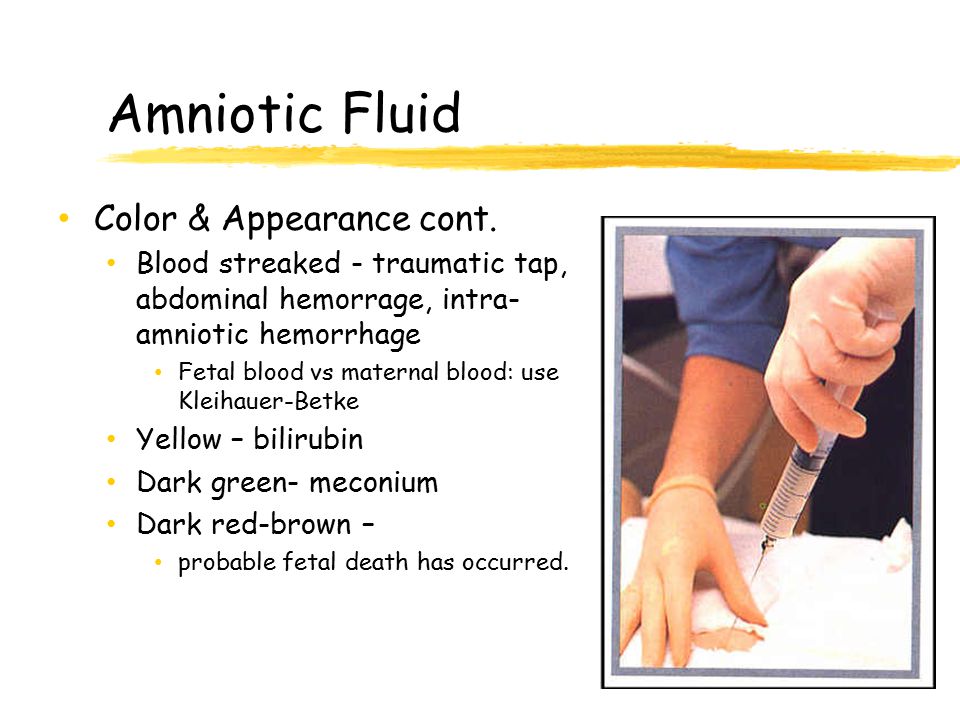 Amniotic Fluid Color & Appearance cont.