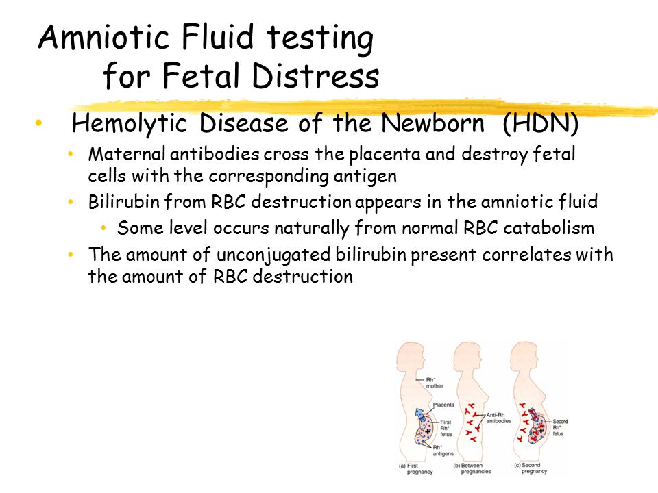 Amniotic Fluid testing for Fetal Distress