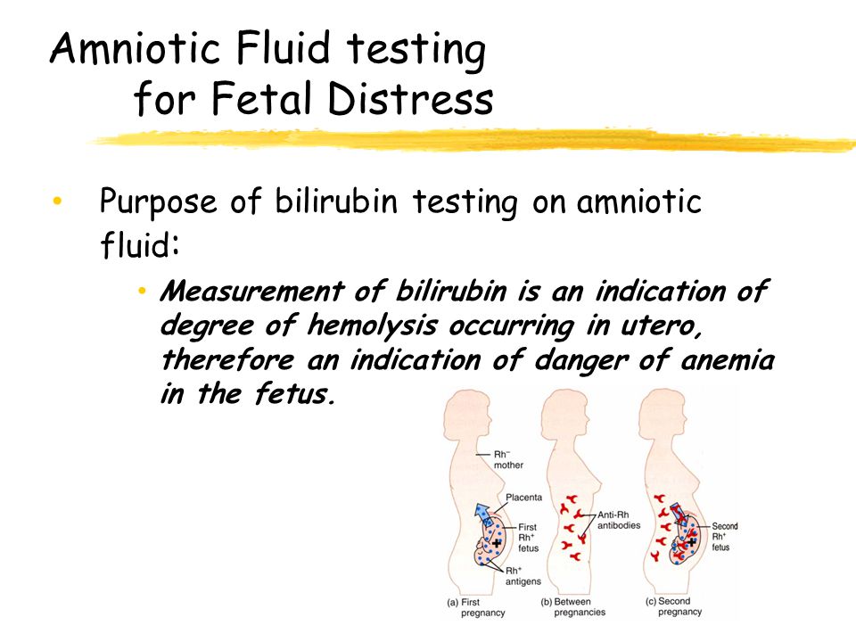 Amniotic Fluid testing for Fetal Distress