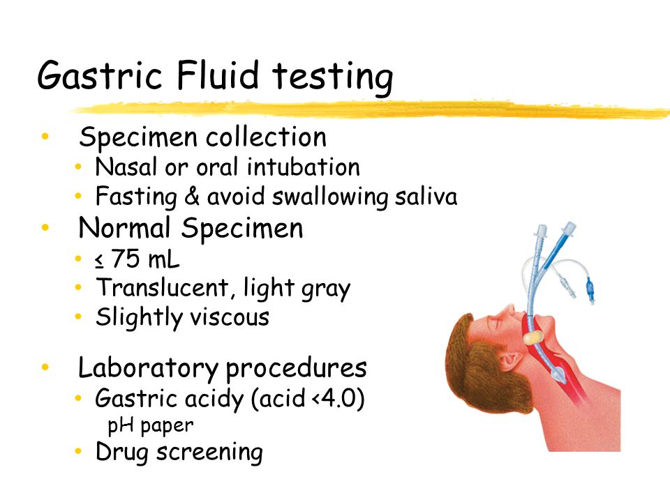 Gastric Fluid testing Normal Specimen Specimen collection