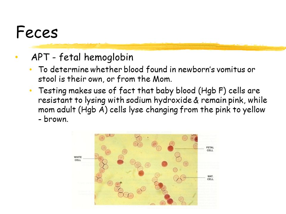 Feces APT - fetal hemoglobin