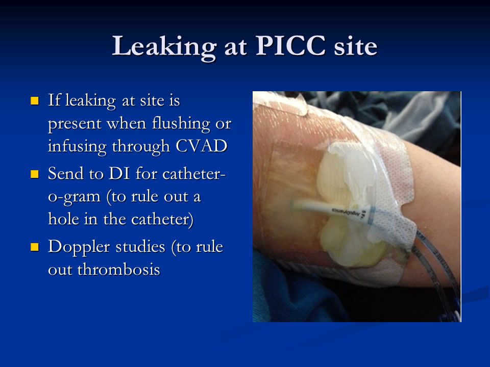 Peripherally Inserted Central Catheter Picc Trouble Shooting Ppt Video Online Download