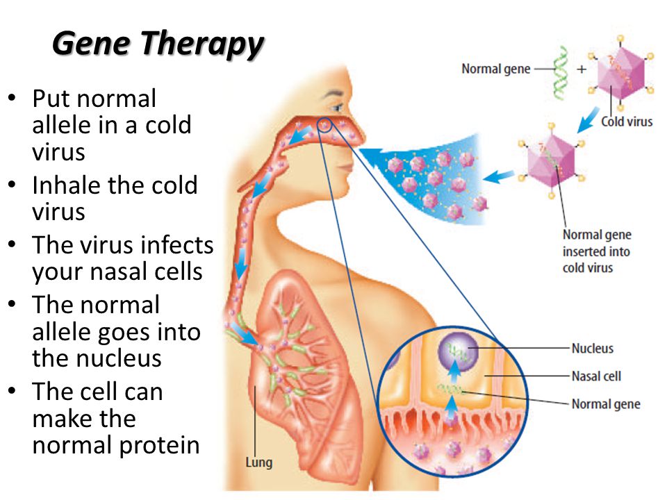 Gene Therapy Put normal allele in a cold virus Inhale the cold virus