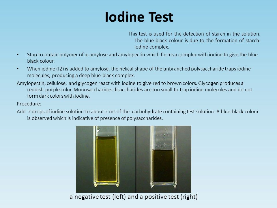 Iodine Test a negative test (left) and a positive test (right)
