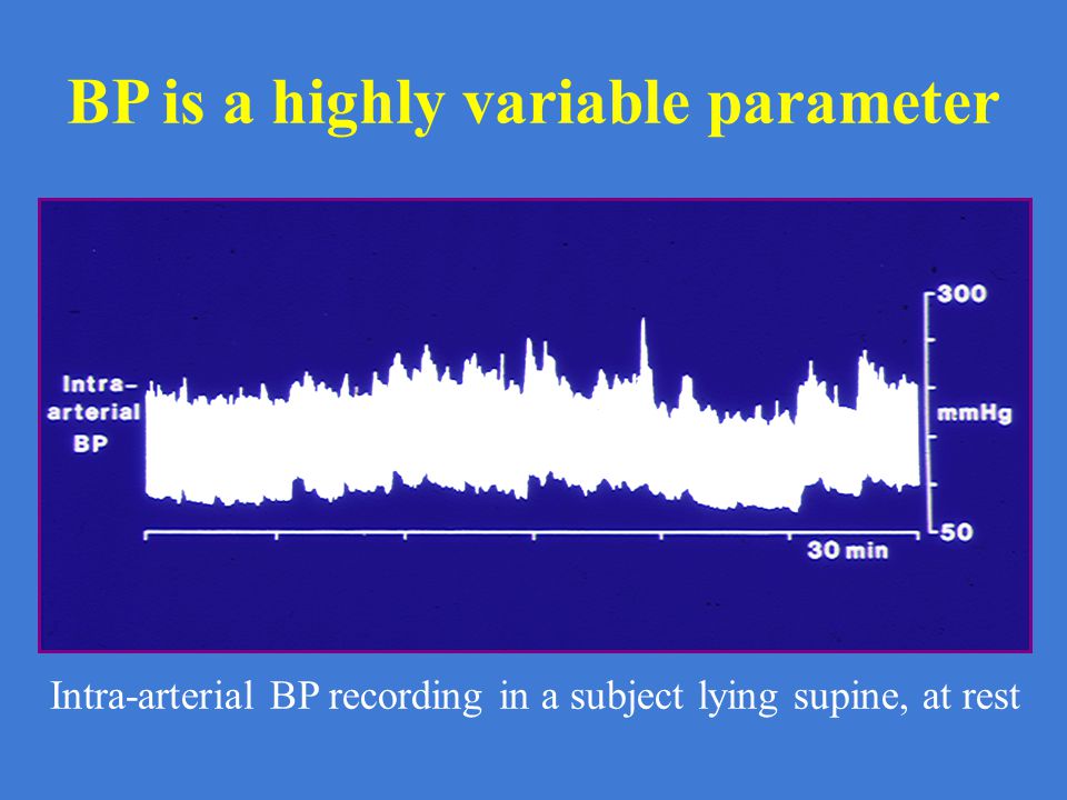 BP is a highly variable parameter