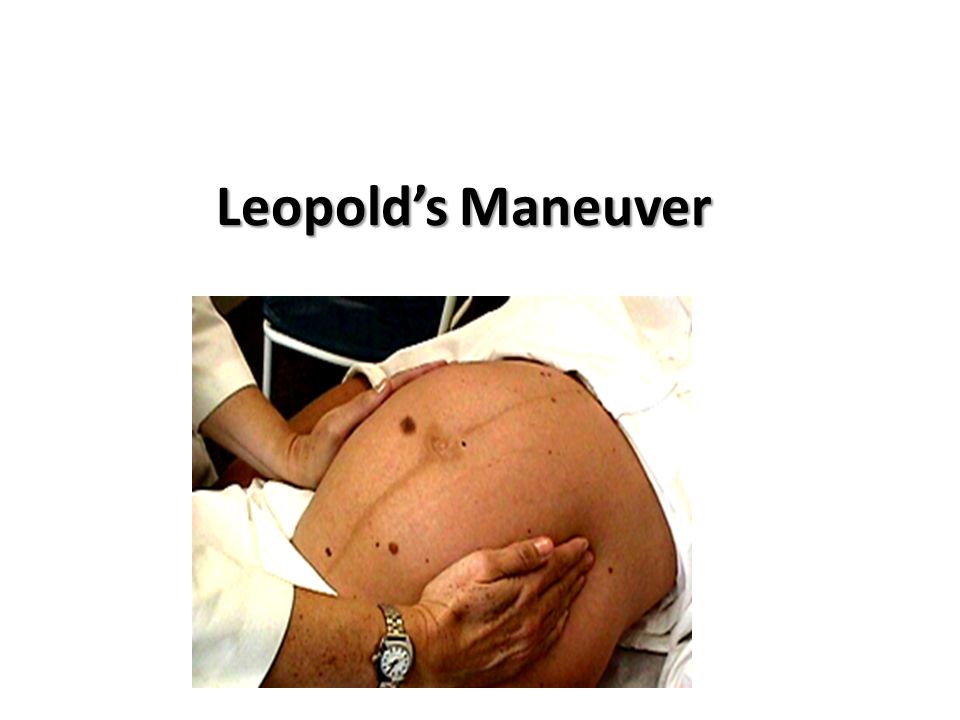 Leopold’s Maneuver
