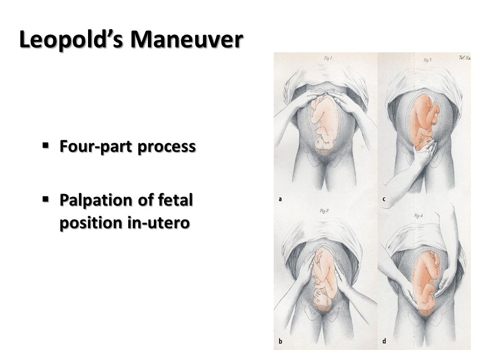 Leopold’s Maneuver Four-part process
