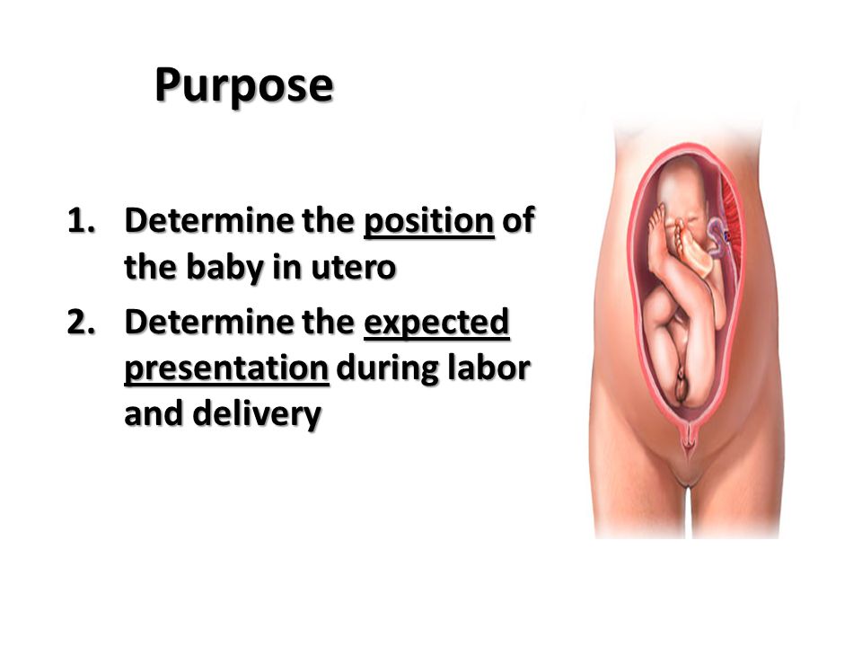 Purpose Determine the position of the baby in utero