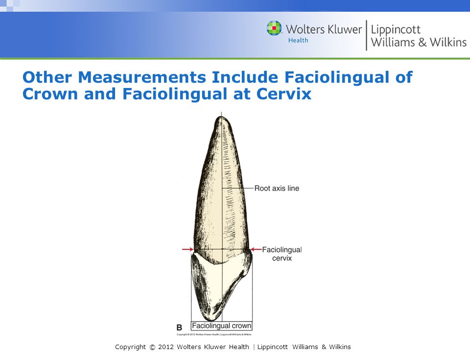 Other Measurements Include Faciolingual of Crown and Faciolingual at Cervix