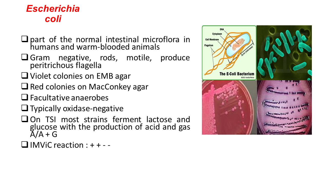 Escherichia coli что это у мужчин. Бактерия эшерихия коли. Штамм бактерий Escherichia coli. Эшерихия коли заболевания. Эшерихия коли под микроскопом.