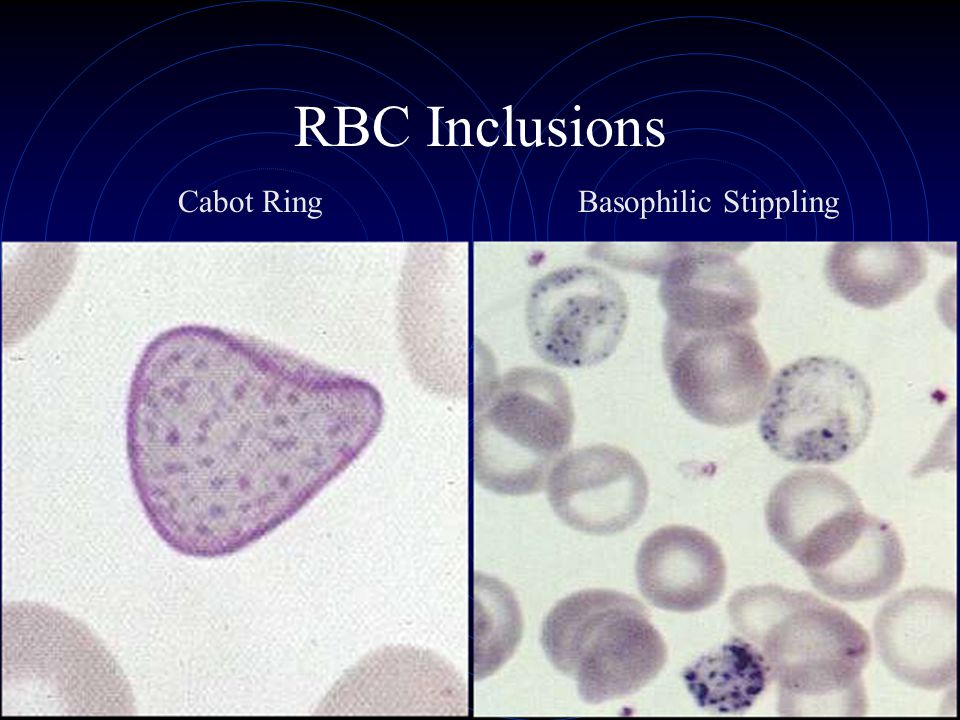 complete blood count, red blood cell morphology
