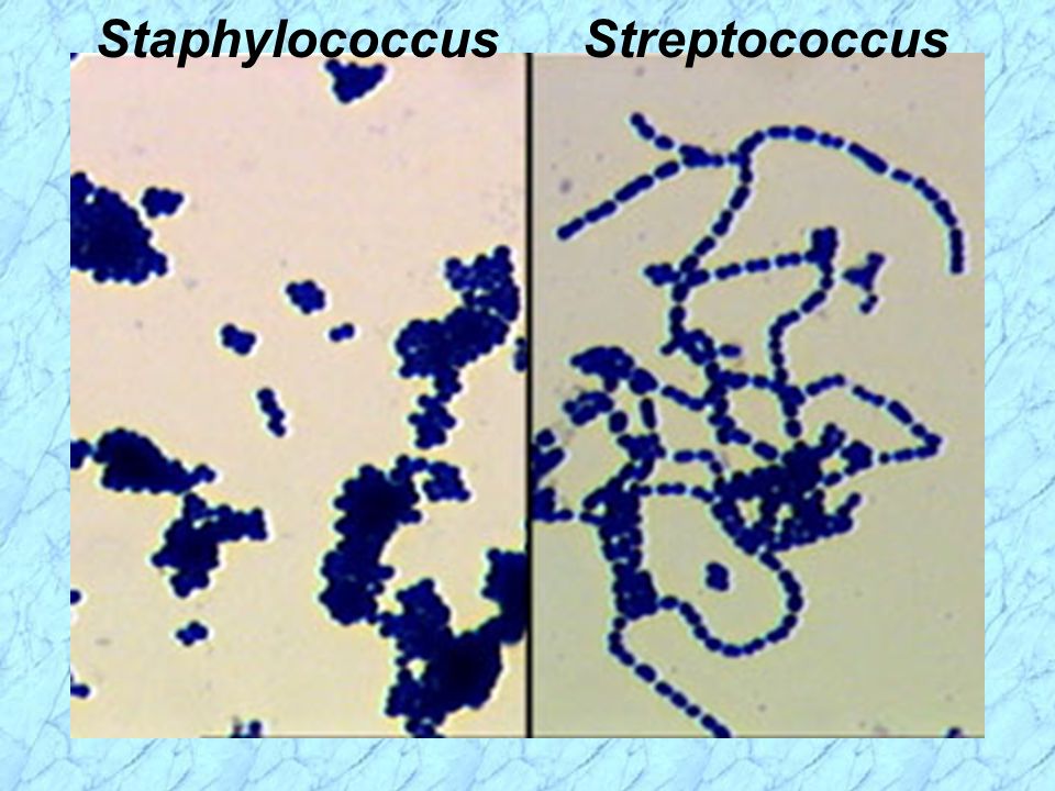 S aureus рисунок