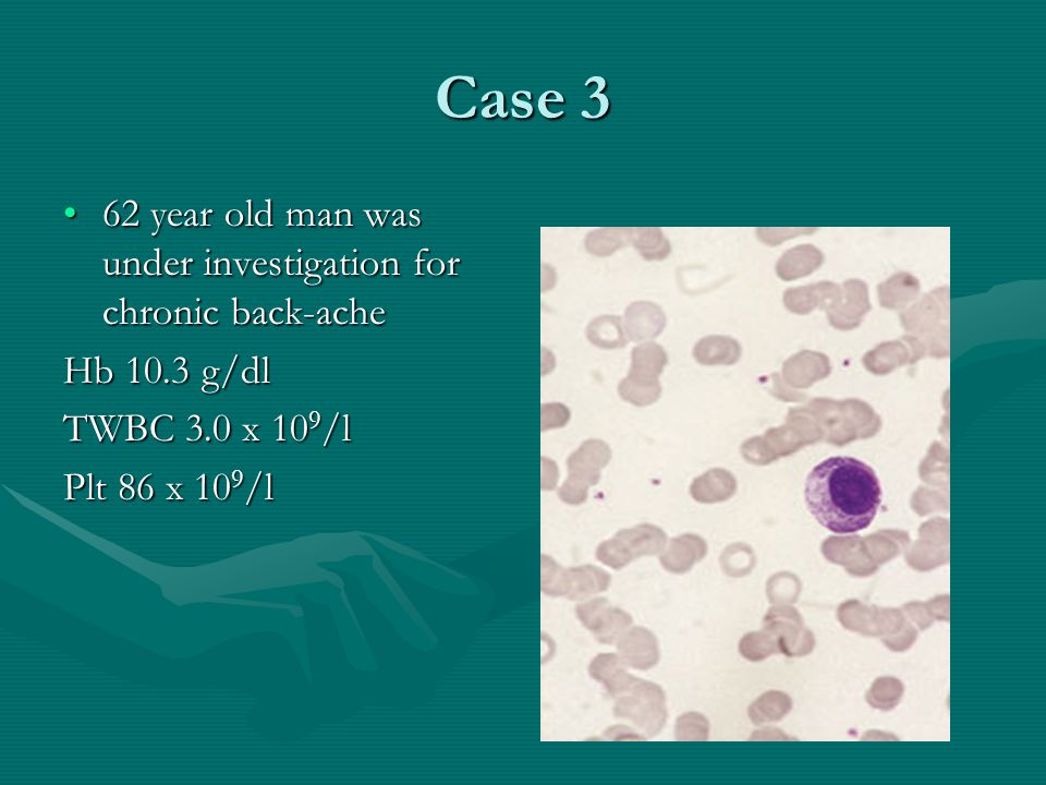 Case 3 62 year old man was under investigation for chronic back-ache