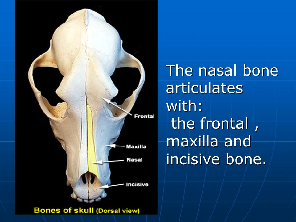 The nasal bone articulates with: