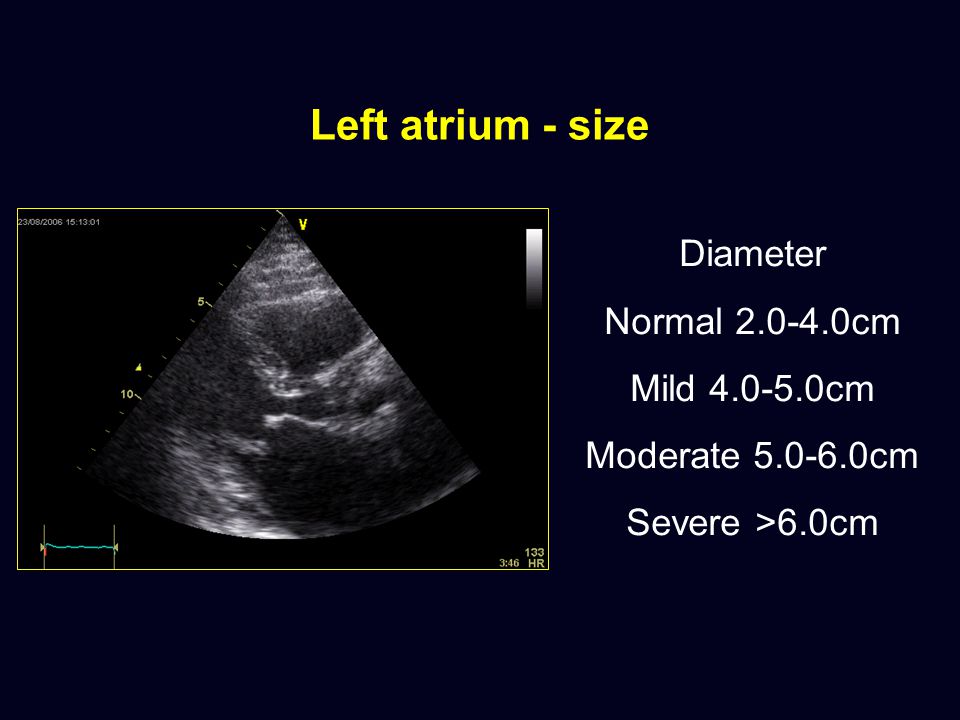 Basic Echocardiography - ppt video online download
