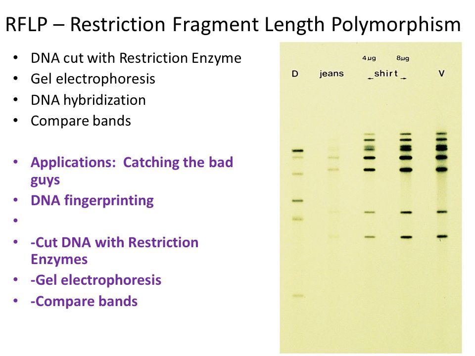 restriction enzymes gel electrophoresis
