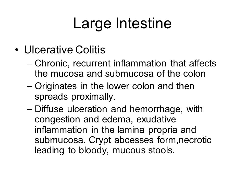 Large Intestine Objectives. - ppt video online download