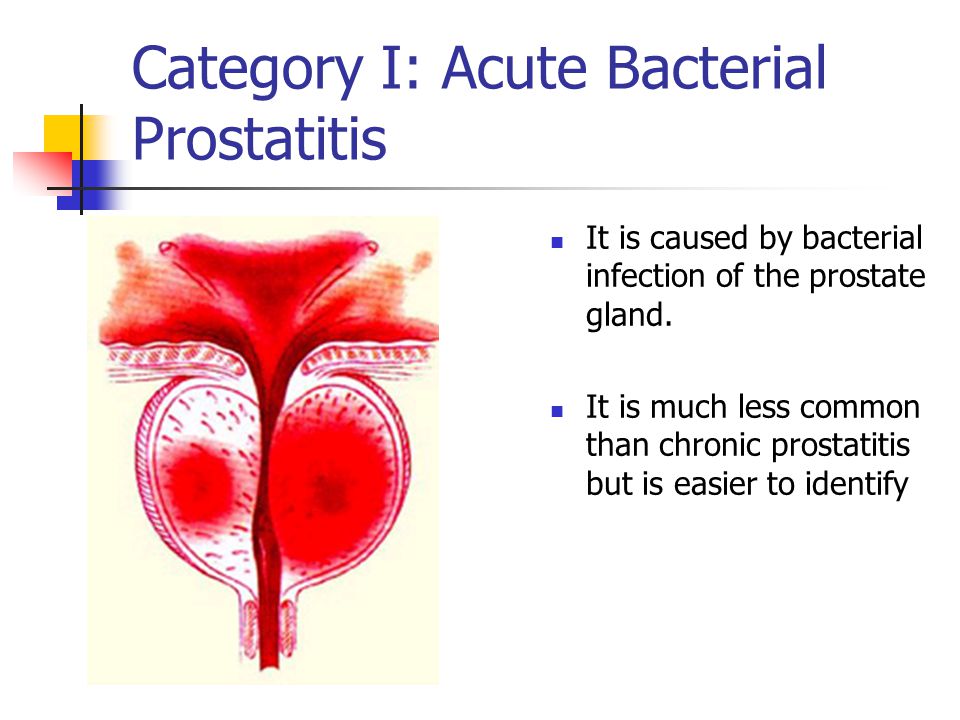 Prostatitis és kamilla