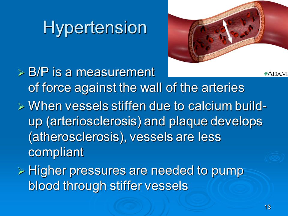 Hypertension B/P is a measurement of force against the wall of the arteries.