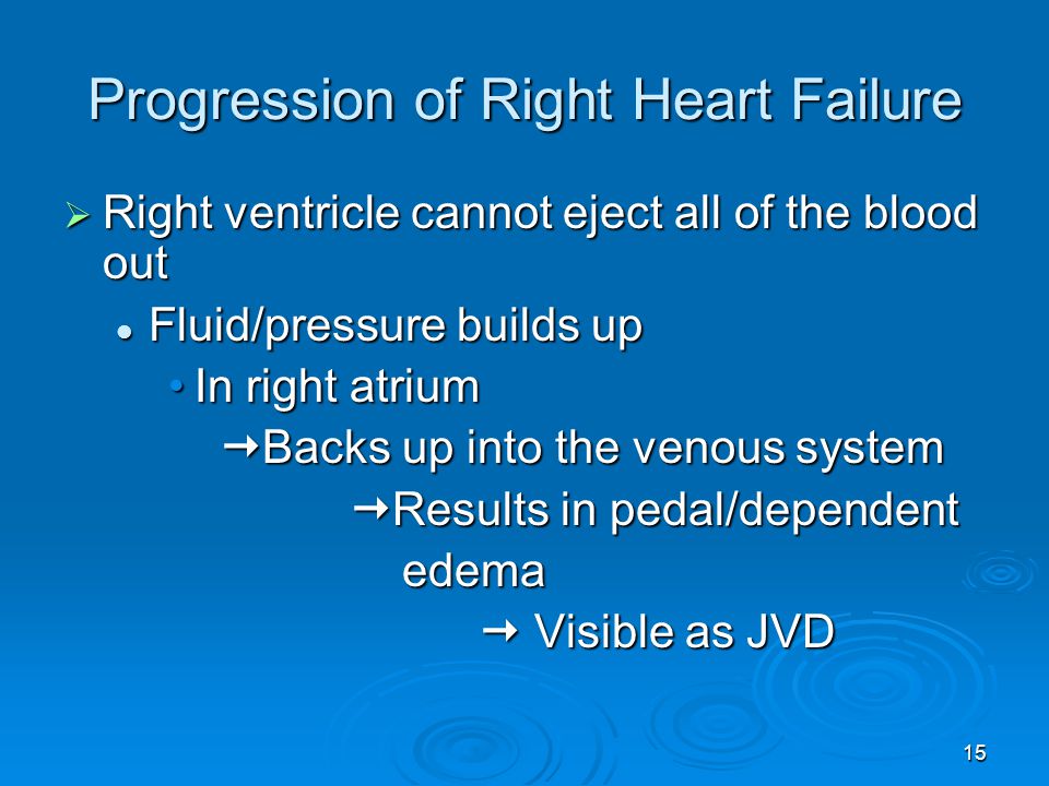 Progression of Right Heart Failure