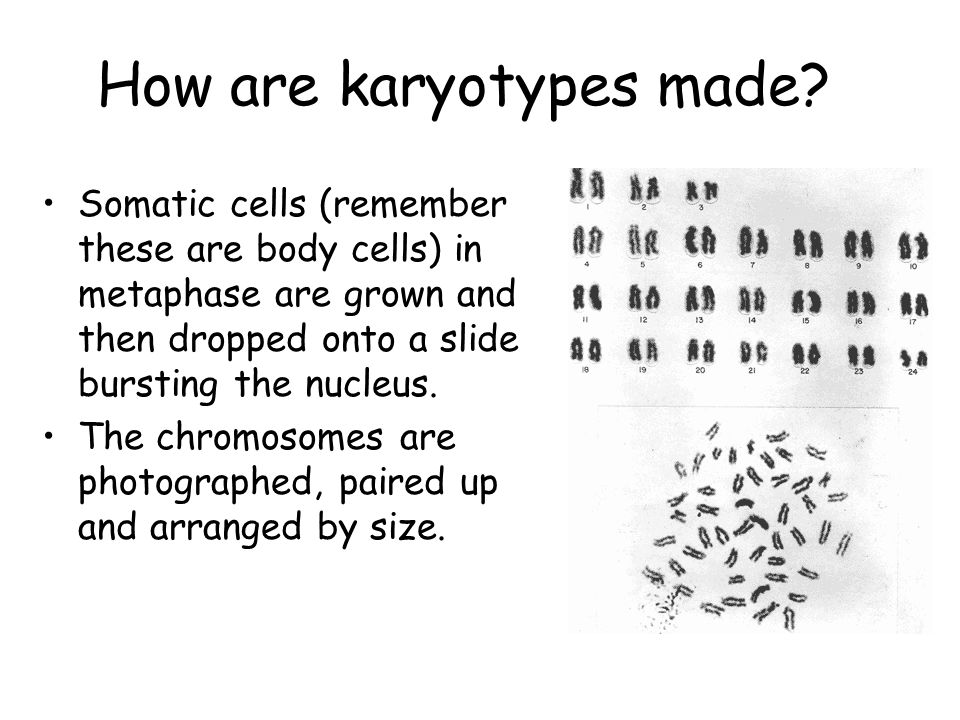 What Is A Karyotype Chart