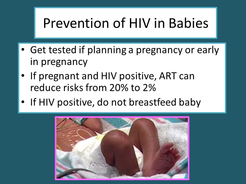 Prevention of HIV in Babies