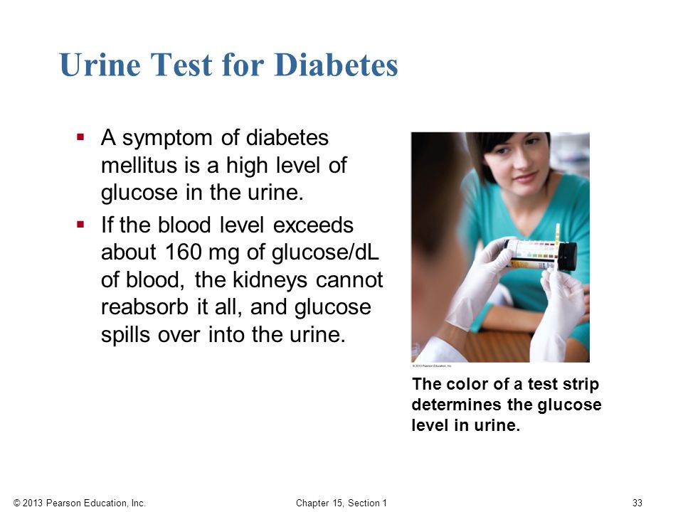 Urine Test for Diabetes