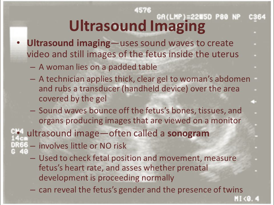 Ultrasound Imaging Ultrasound imaging—uses sound waves to create video and still images of the fetus inside the uterus.