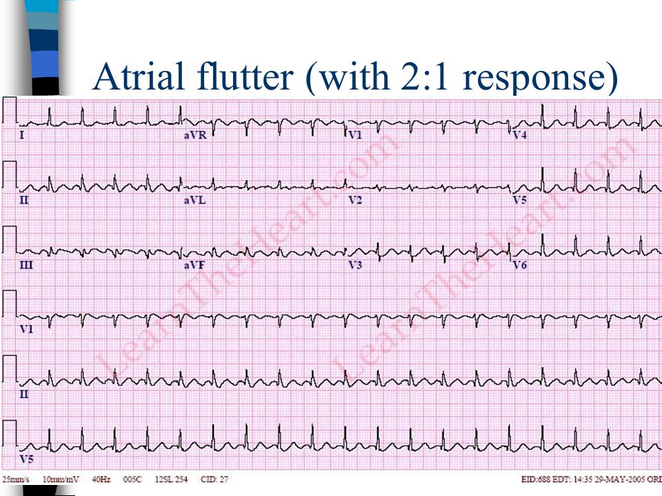 1 flutter