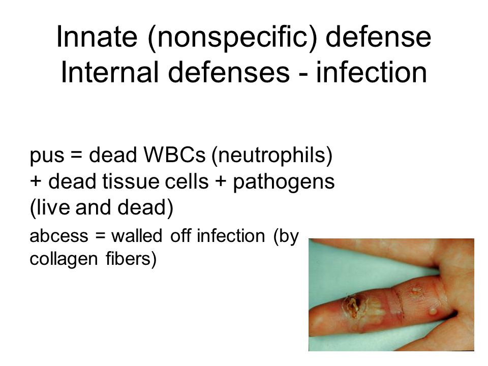 Innate (nonspecific) defense Internal defenses - infection