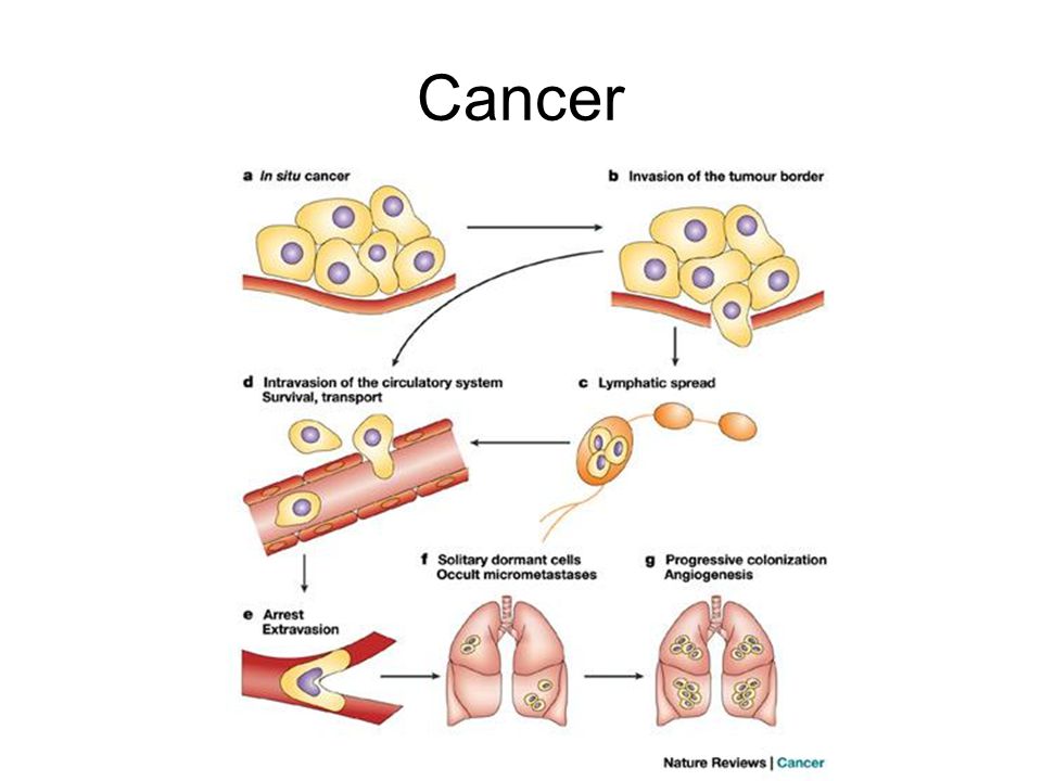 Cancer Once cells acquire adhesins and proteases they can move through the tissues by adhering to connective fibers and then cutting them.