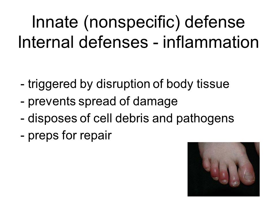 Innate (nonspecific) defense Internal defenses - inflammation