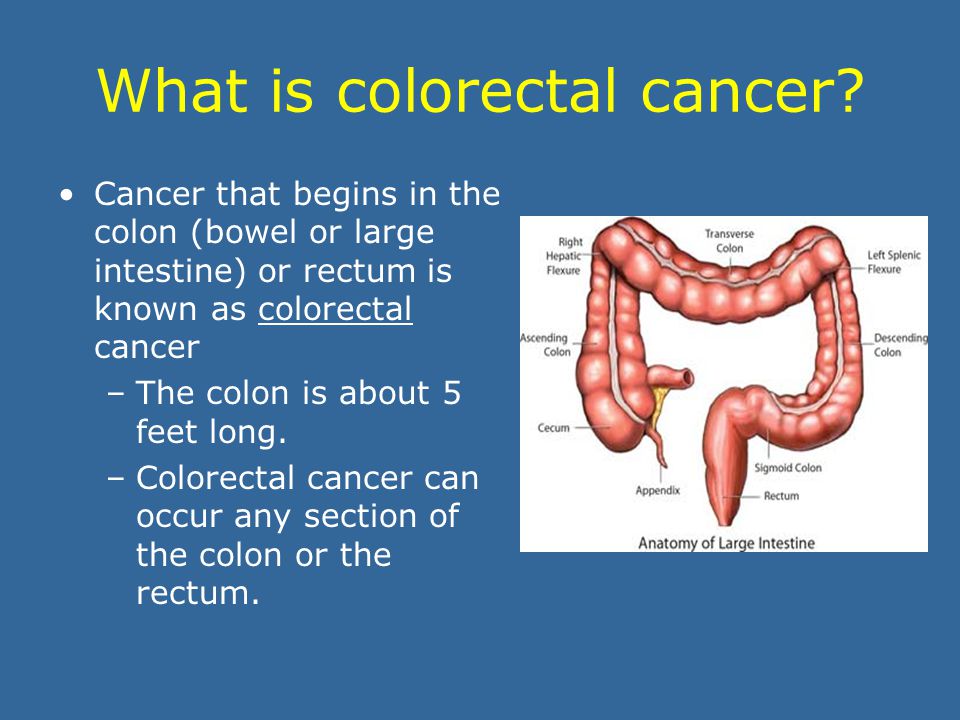 Overview of Colorectal Cancer