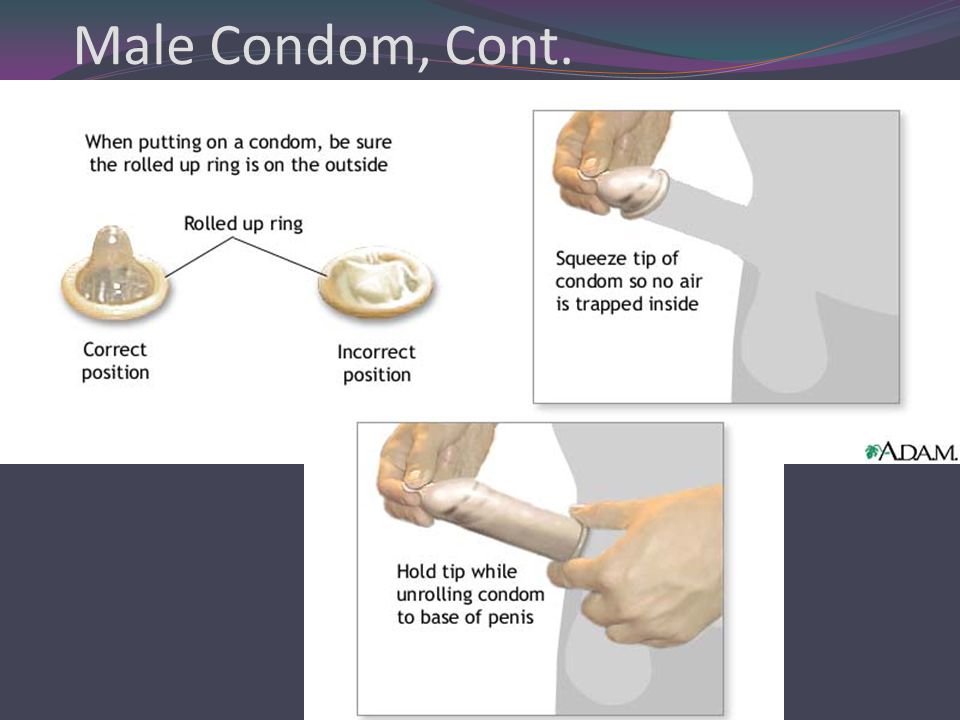 Male Condom, Cont.