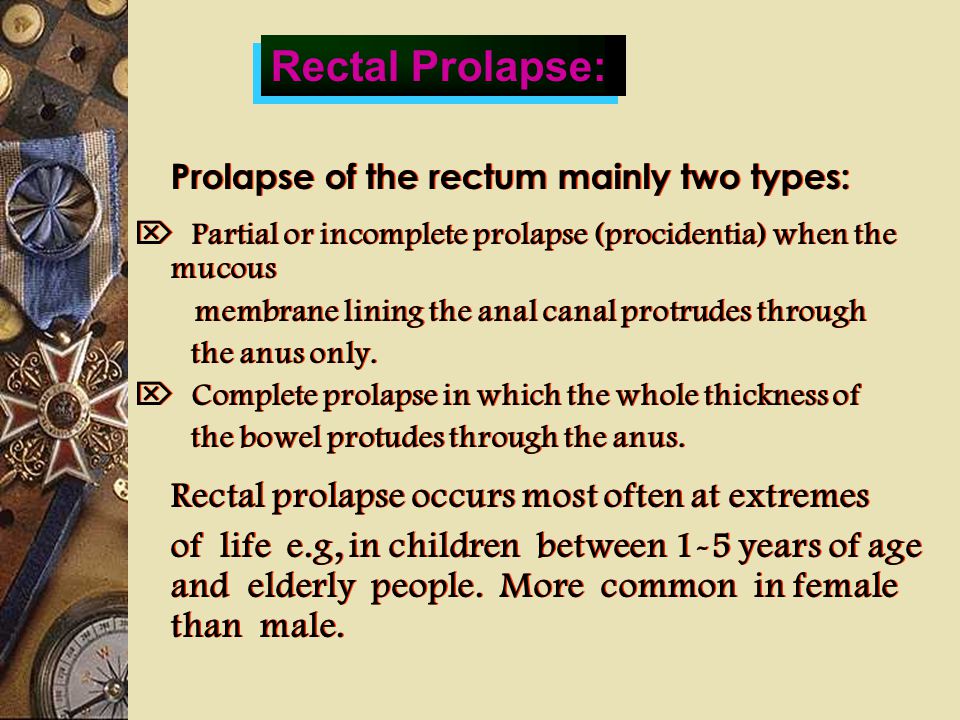 RECTAL PROLAPSE. ppt video online download