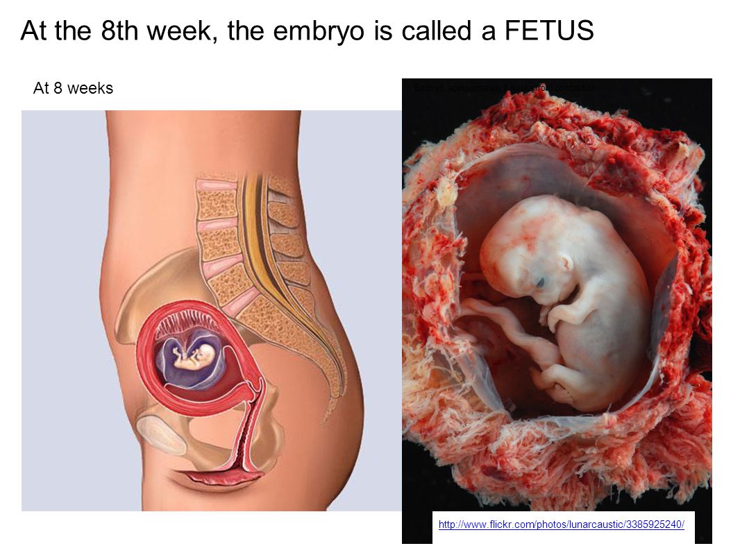 Какой ребенок 8 недель. Ребёнок на 8 неделе беременности. Плод на 8 неделе беременности. Где расположен ребенок на 8 неделе. Ребенок на 7-8 недели беременности.