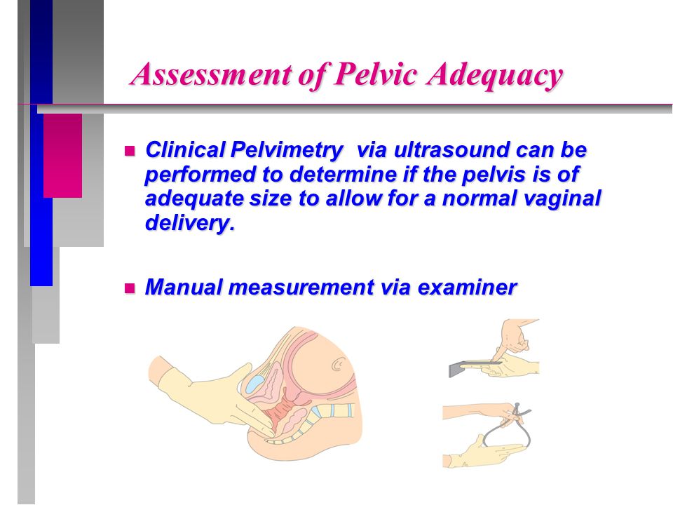 Assessment of Pelvic Adequacy